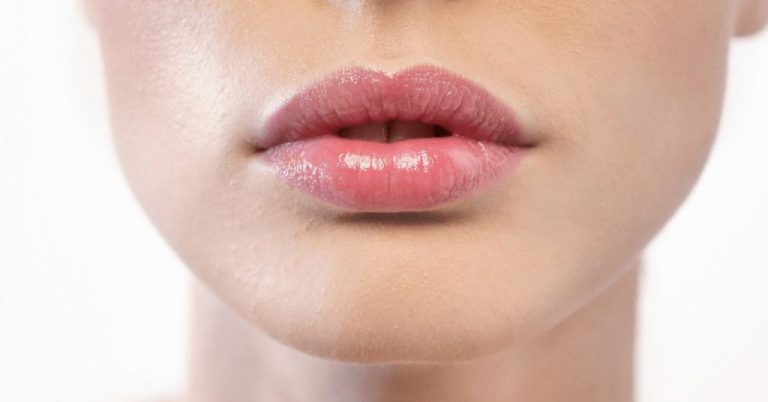 Everything You Need To Know Before Putting Fillers In Your Lips